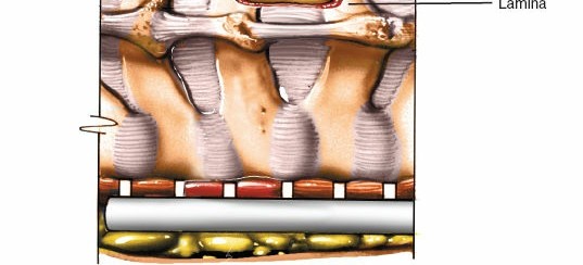 Illustration 187 for Approach to the Lumbar Spine: Mastering Techniques & Anatomy