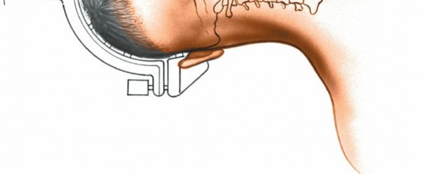 Illustration 168 for Approach to the Lumbar Spine: Mastering Techniques & Anatomy