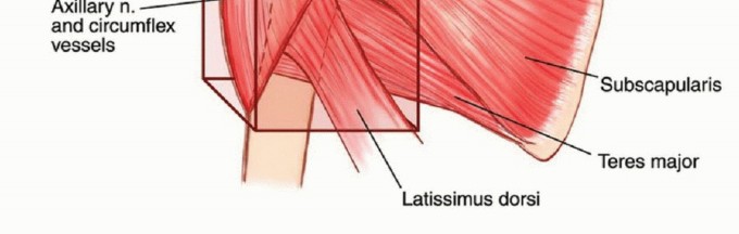 Illustration 13 for Limb-Sparing Resections Around the Shoulder: Optimizing Outcomes