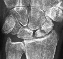 صورة طبية: دليل الأستاذ الدكتور محمد هطيف الشامل لأمراض وإصابات اليد والمعصم في صنعاء