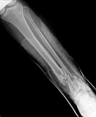 Illustration 147 for OrthoCash: Trauma MCQs & Cases for a yearold woman