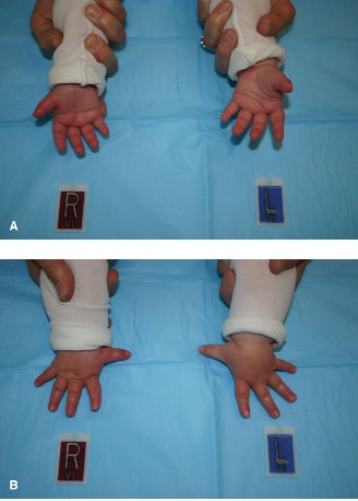 Illustration of first web space - Dr. Mohammed Hutaif