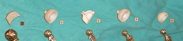 Illustration 17 for Mastering Hip Arthroplasty: Its Evolution and Design Unveiled