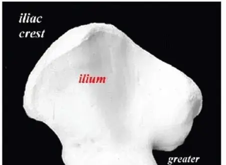 صورة توضيحية لـ جراحات تثبيت كسور الحوض والمفصل العجزي الحرقفي: دليل المريض الشامل