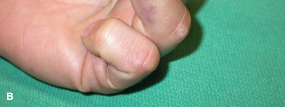 Illustration 10 for Orthopedic Hand Cases: A Patient's Journey, Is a Year Old a Factor?