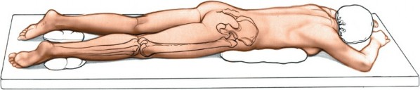 Illustration 35 for Optimal Femoral Approaches: Mastering the Lateral Intermuscular Septum