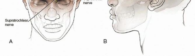 Illustration 2 for Master Techniques for Cervical Fracture Reduction: Type III & More