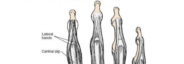 Illustration 29 for Essential Surgical Approaches: Uncover Every Aspect of the Wrist