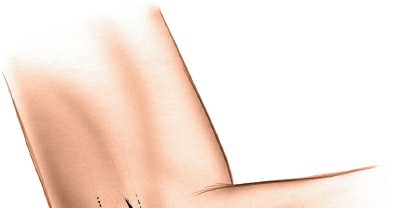 Illustration 73 for Mastering the Approach to the Distal Humerus: Safety & Skills