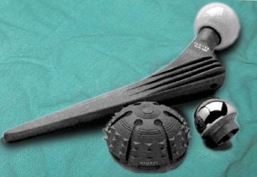 Illustration 26 for Mastering Hip Arthroplasty: Its Evolution and Design Unveiled