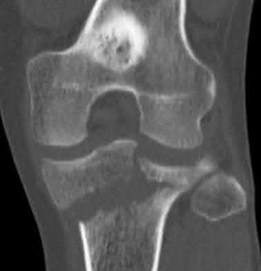 Illustration 41 for OrthoCash: Trauma MCQs & Cases for a yearold woman