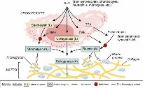 Illustration of arthritides arthritides arthritides - Dr. Mohammed Hutaif