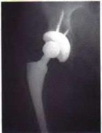 Orthopedic Adult Reconstructiv Review | Dr Hutaif Hip & -...