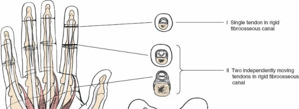 Illustration 9 for Unlock Easier Access: Dorsal Approach for Phalanges and Interphalangeal Joints