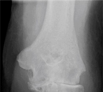 Illustration 50 for Solve Shoulder & Elbow Cases: When a Patient Presents to Clinic
