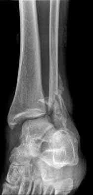 Illustration 94 for OrthoCash: Trauma MCQs & Cases for a yearold woman