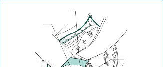 Illustration 34 for Mastering Thoracolumbar Surgery: Full Operative Planning