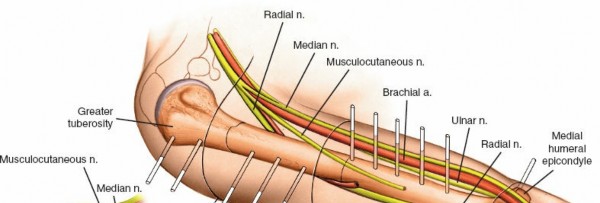 Illustration 2 for Key Approaches for External Fixation: Humerus, Radius, Ulna, Wrist