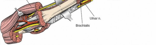 Illustration 18 for Mastering the Approach to the Distal Humerus: Safety & Skills