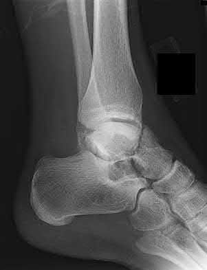 Illustration 119 for OrthoCash: Trauma MCQs & Cases for a yearold woman