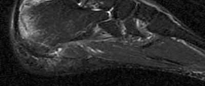 Illustration 107 for OrthoCash: Trauma MCQs & Cases for a yearold woman