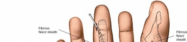 Illustration 213 for Essential Surgical Approaches: Uncover Every Aspect of the Wrist