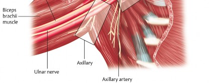Illustration of perioperative pain management - Dr. Mohammed Hutaif