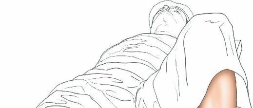Illustration 119 for Surgical Access: Mastering the Tibia's Surface & Fibula Approaches