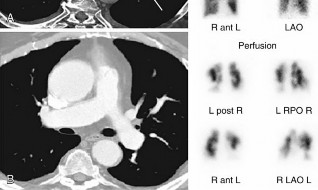 Illustration 10 for Perioperative & Orthopaedic Medicine: Preventing Dangerous Blood Clots