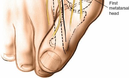 Illustration 194 for Optimized Approaches to the Dorsum of the Foot & Ankle