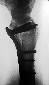 صورة طبية: دليل الأستاذ الدكتور محمد هطيف الشامل لأمراض وإصابات اليد والمعصم في صنعاء