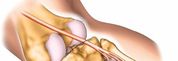 Illustration 49 for Surgical Access: Mastering the Tibia's Surface & Fibula Approaches