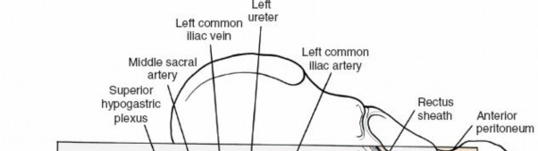 Illustration 117 for Approach to the Lumbar Spine: Mastering Techniques & Anatomy