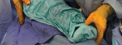 Illustration 42 for Unlock better THA: The technique of short stem for less invasiveness