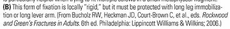 Illustration 20 for Master Pediatric Femoral Shaft & Knee Fractures: Interactive Module