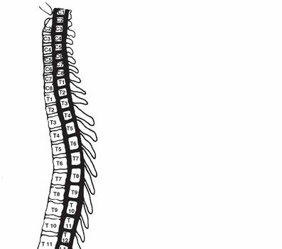 Unraveling Thoracolumbar Spine Injuries: What You Must Know