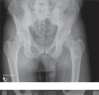 Fibrous Dysplasia: Key Insights from Oncology Cases