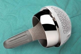 Illustration 56 for Mastering Hip Arthroplasty: Its Evolution and Design Unveiled