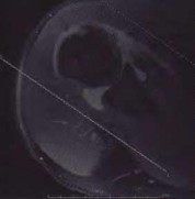 Orthopedic Review | Dr Hutaif General Orthopedics Revie -...