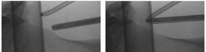 Illustration 30 for Beyond Knee Surg: Hip Arthroscopy for Sports Injuries