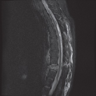 Illustration 60 for Master Orthopedic Spine Cases: Sharpen Your Diagnostic Skills