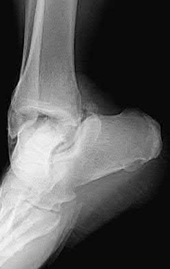 Illustration 6 for OrthoCash: Trauma MCQs & Cases for a yearold woman