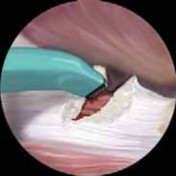 Illustration 12 for J. W. Thomas on Snapping Hip: Causes, Cures & Relief