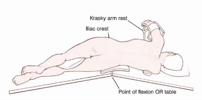 Illustration 7 for Anterior Flap Hemipelvectomy: Leveraging fig tech fig for Difficult Tumors