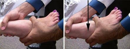 Illustration 19 for First Metatarsal Surgery: Expert Solutions for Foot & Ankle Pain