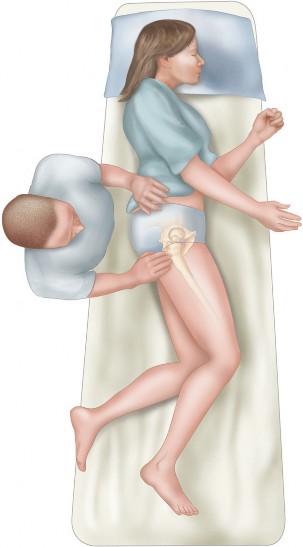 Illustration 7 for Bernese PAO: Unlocking the Procedure with Level V Evidence Insights