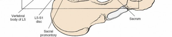 Illustration 129 for Approach to the Lumbar Spine: Mastering Techniques & Anatomy