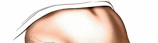 Illustration 9 for Unlocking Every Aspect of the Hip's Surgical Approaches