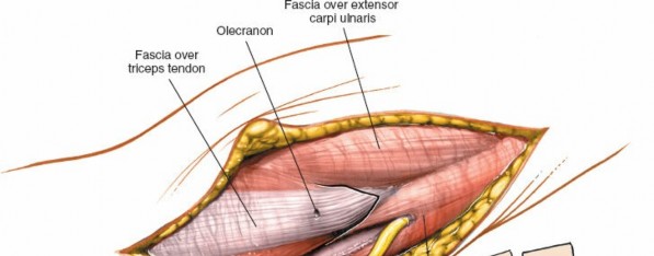 Illustration 6 for Mastering Elbow Approaches: Applied Surgical Anatomy for Precision