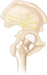 جراحة مفصل الورك المراجعة: دليل شامل للنهج الجانبي المباشر لنتائج أفضل في صنعاء